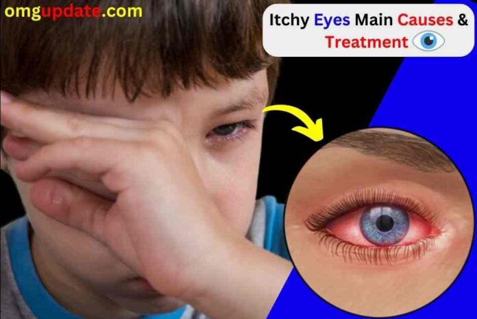 Itchy Eyes Main Causes and Treatment