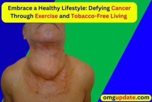 Defying-Cancer-Through-Exercise-and-Tobacco-Free-Living