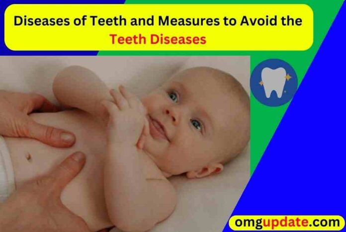 Precaution During Dentition of Infants